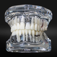 1 szt. Model dentystyczny Zęby Implant Przywrócenie mostu Badanie dydaktyczne Ząb Nauki medyczne Choroby dentysty Produkty stomatologiczne 5